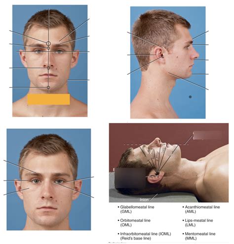 Skull Cranium Topography Landmarks Diagram Quizlet