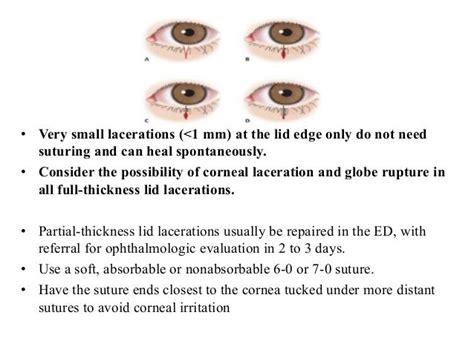 Ocular Injuries