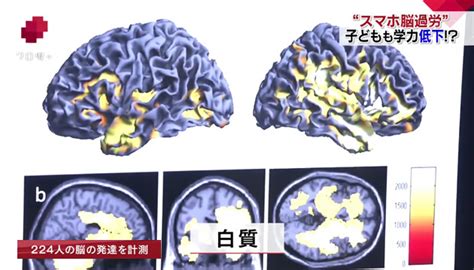 【スマホ脳過労とは】記憶力低下や無気力など悪影響が Nhk クローズアップ現代 全記録