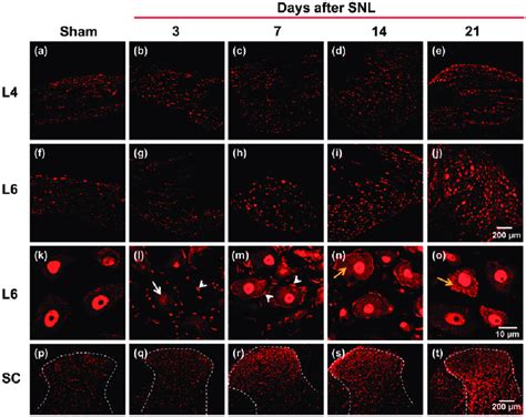 Spinal Nerve Ligation SNL Enhances ATF2 Immunoreactivity At The DRG