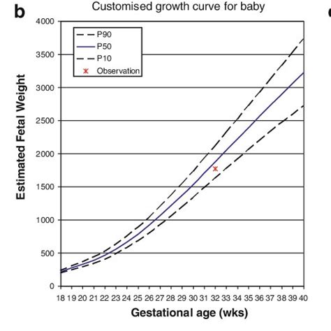 Formula For Estimated Fetal Weight For Individually Customised Growth