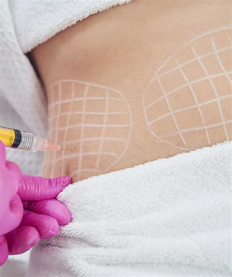 Aqualyx Fat Dissolving Injections Skin Deep Aesthetics