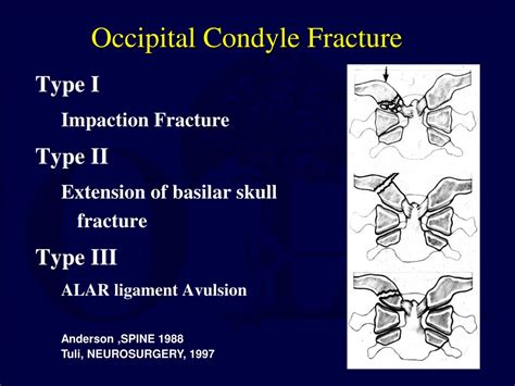 Ppt Upper Cervical Spine Fractures Powerpoint Presentation Free Download Id 664141