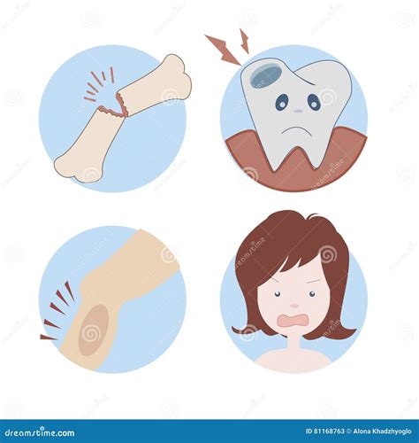 Calcium Deficiency. Sign, Symptoms, And Sources Cartoon Vector | CartoonDealer.com #170694795