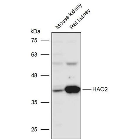 Solarbio K P Anti Hao Polyclonal Antibody