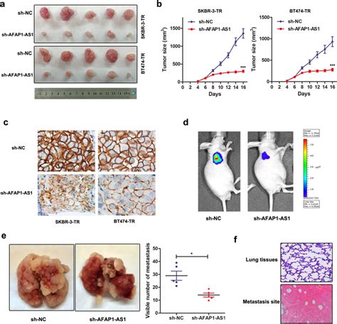 Knockdown Of AFAP1 AS1 Reversed Trastuzumab Resistance In Vivo A