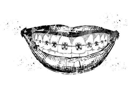 Teeth Braces Digital Art By Erzebet S Fine Art America