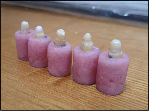 Specimens Held In Acrylic Resin Blocks Download Scientific Diagram