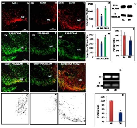 Representative Immunofluorescent Staining Western Blot Open I