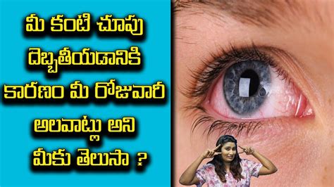 Common Eye Problems Symptoms Causes And Treatment Eye Diseases Youtube