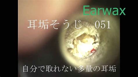 わんちゃん 耳掃除 Ear Wax Drops Ep 113 耳掃除 中国 Youtube