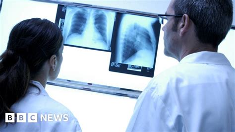 'Hidden shortage' of radiologists across Scotland