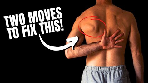 Fix Scapular Winging In 10 Minutes Real Results YouTube