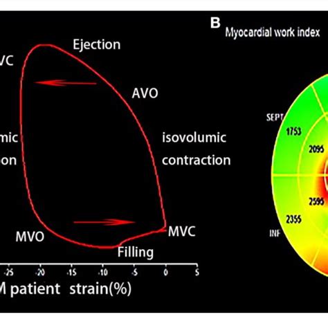 Longitudinal Strain And Myocardial Work Index Of The Study Population