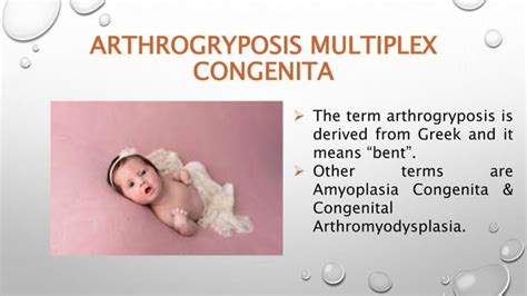 Arthrogryposis Multiplex Congenita