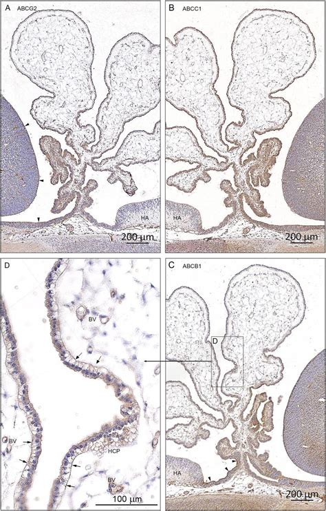 Cellular Distribution Of Abcg2 Abcc1 And Abcb1 Immunoreactivity In Download Scientific Diagram