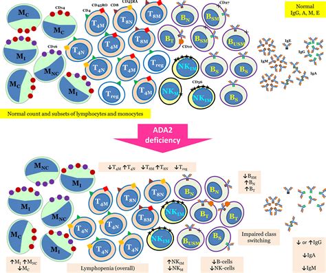 Frontiers Deficiency Of Human Adenosine Deaminase Type A