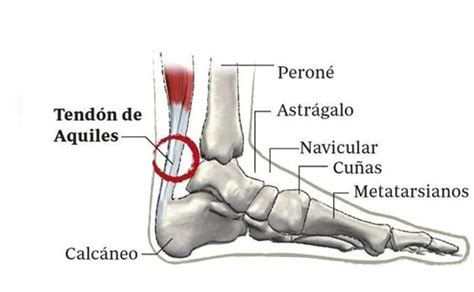 Tend N De Aquiles O Tal N De Aquiles El Diario Vasco