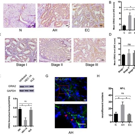 GluR2 Is Expressed In EC Cell Lines And Tissues A D IHC Analysis Of