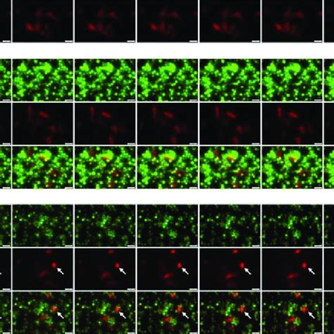 Live Cell Imaging Of Nk 92 αfr 28bbζ Gfp Cell Killing Of Sk Ov 3 Rfp