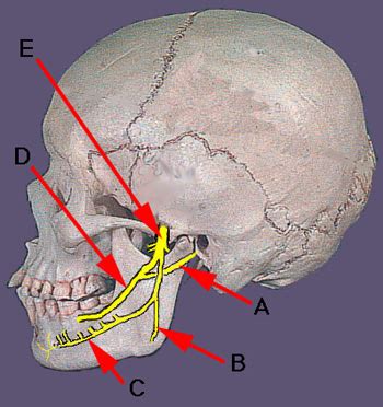 Petrotympanic Fissure Chorda Tympani