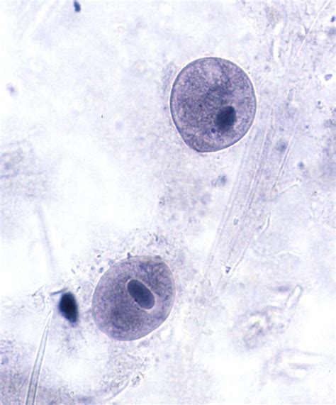 Balantidium Coli Cyst Label