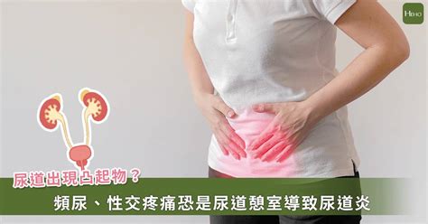 女性尿道炎為什麼難康復？小心尿道憩室好發中年婦女 Heho健康 Line Today