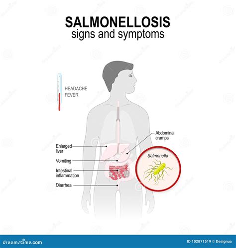 Symptoms Of Salmonellosis. The Structure Of Salmonella. Infographics. Vector Illustration On ...