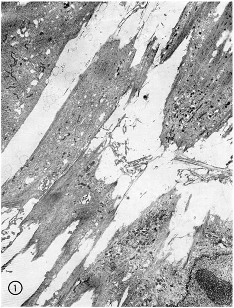 A Low Power Electron Micrograph Of A Tangential Section Of Part Of A