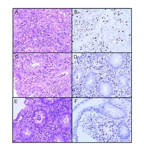 Histopathology Specimens From Patient 1 A Liver Biopsy Showing Download Scientific Diagram