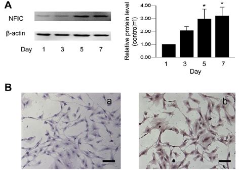 Protein Levels Of Nfic In Dfcs A Changes In Nfic Protein Expression In