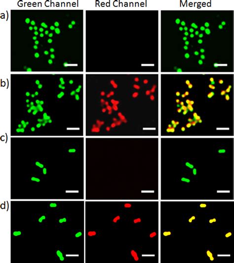 Fluorescence Microscopy Of A B S Aureus And C D E Coli Upon