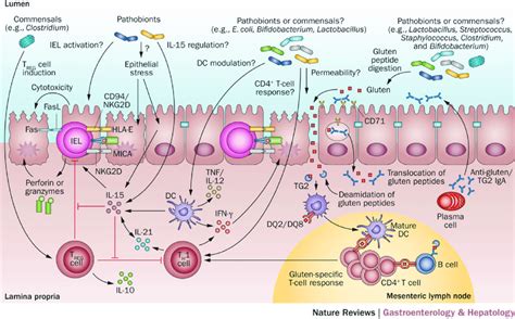 4 Microbial Modulation Of Celiac Disease Pathogenesis From Verdu E