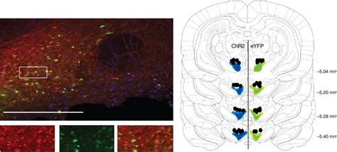 Immunohistochemical Verification Of Cre Dependent Chr2 And Eyfp Download Scientific Diagram