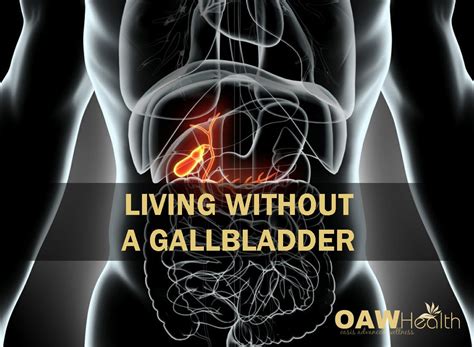 Living Without A Gallbladder Oawhealth