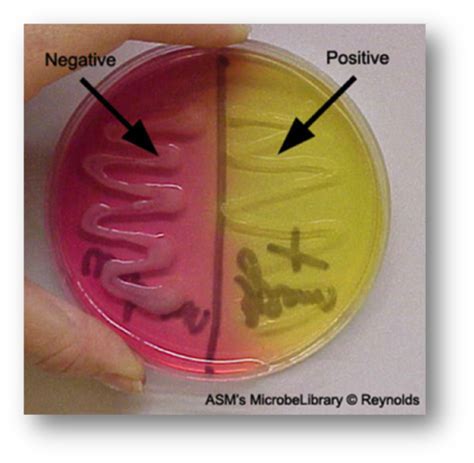 MSA Agar Flashcards | Quizlet