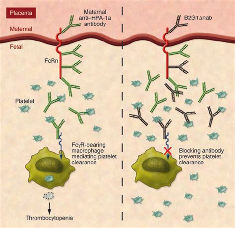 Interfering With Fc γ R Mediated Platelet Phagocytosis In Fmait In