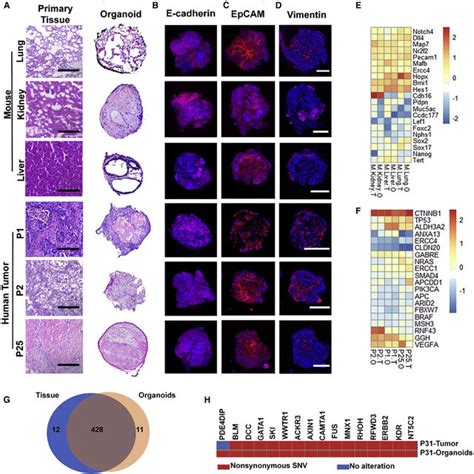 Histopathological Characterization And Gene Expression Profiling Of