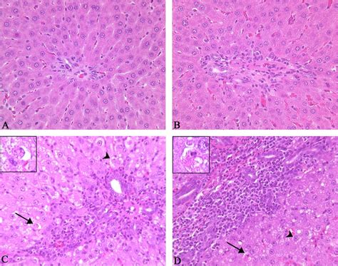 —representative Hematoxylin And Eosin Hande Stained Histological Liver