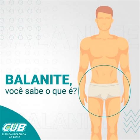 Você sabe o que é balanite CUB Clínica Urológica da Bahia