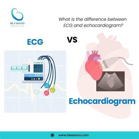 What Is The Difference Between Ecg And Echocardiogram Blessono