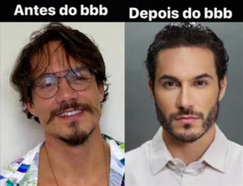 Eliezer Antes E Depois - Eliezer compartilha mudanças no visual desde que saiu do BBB