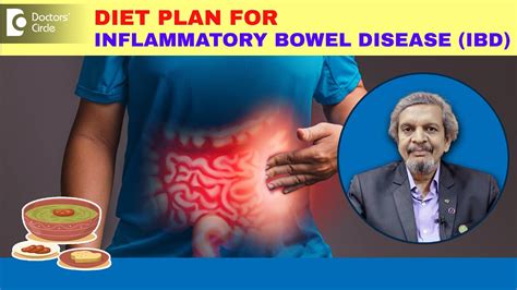 Best Diet Plan For Inflammatory Bowel Disease Ibd Diet By Expert Drrajasekhar Mr Doctors