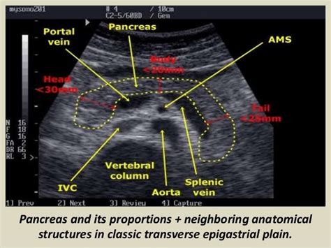 Ultrasound Of Pancrease In Radiology