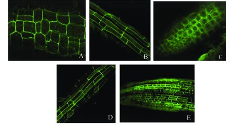 Subcellular Localization Of The Sos Gfp Fusion Protein In Transgenic