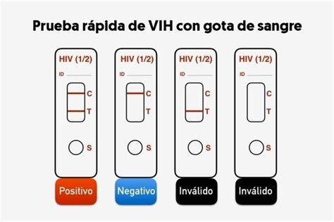 Prueba Rápida De Vih En Saliva Y Sangre Tua Saúde