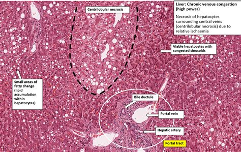 Liver Histology