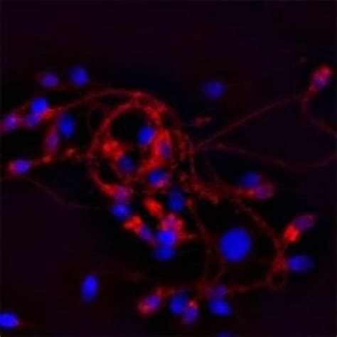 CACNA1I Antibody Azide And BSA Free Novus Biologicals 0 1 Mg