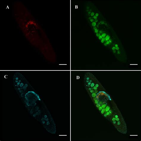 Ciliophora Paramecium