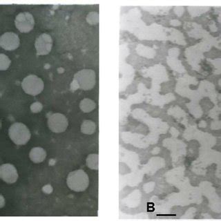 Transmission Electron Microscopy Of Vesicular And Micellar Phases Bar